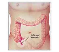 Appendix Organ