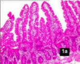 Celiac Villi